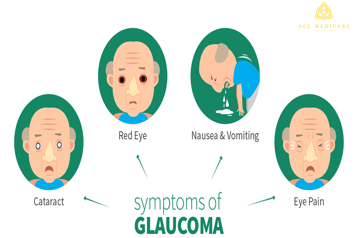 Preventing Progression: How to Slow the Advancement of Glaucoma Through Treat